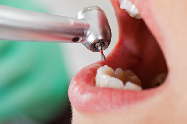 Best Emergency Care for Gum Disease in New Boston, TX
